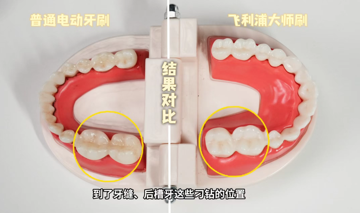 飞利浦专业声波洁牙科技:电动牙刷“功能内卷”之后,谁还在认真把牙刷干净?